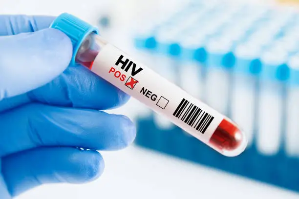 HIV Crisis
